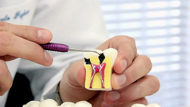 Endodontia (tratamento de canal)